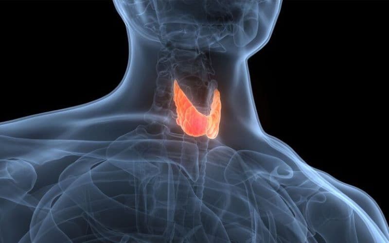 nhiễm độc giáp do T3