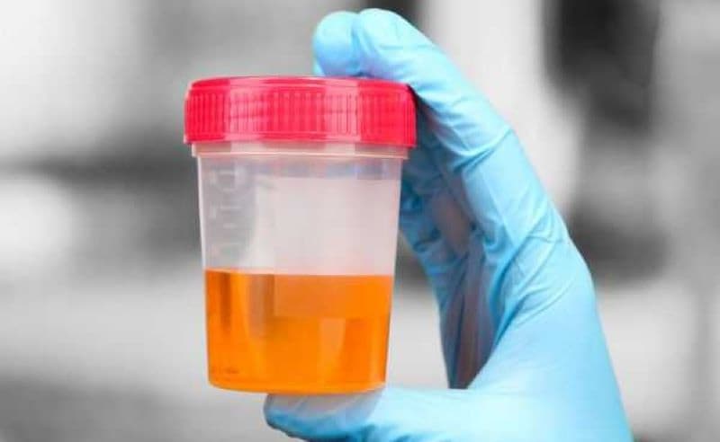 nước tiểu có mùi hôi