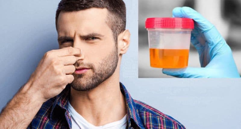 nước tiểu có mùi hôi