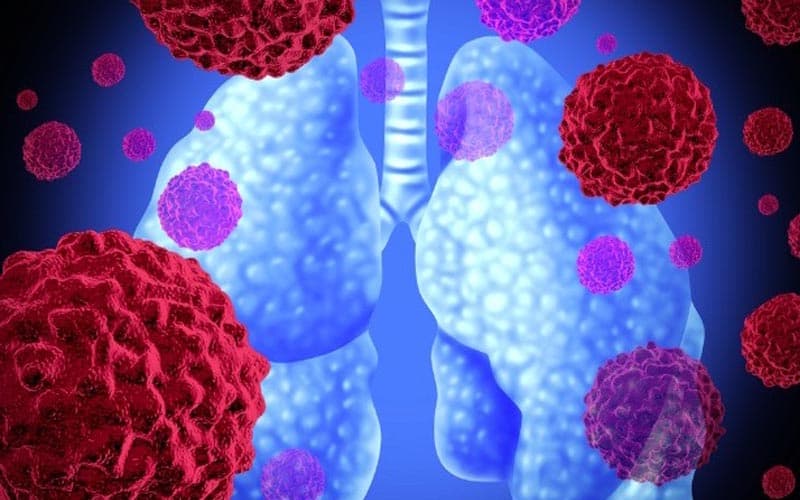 gen PIK3CA ung thư phổi