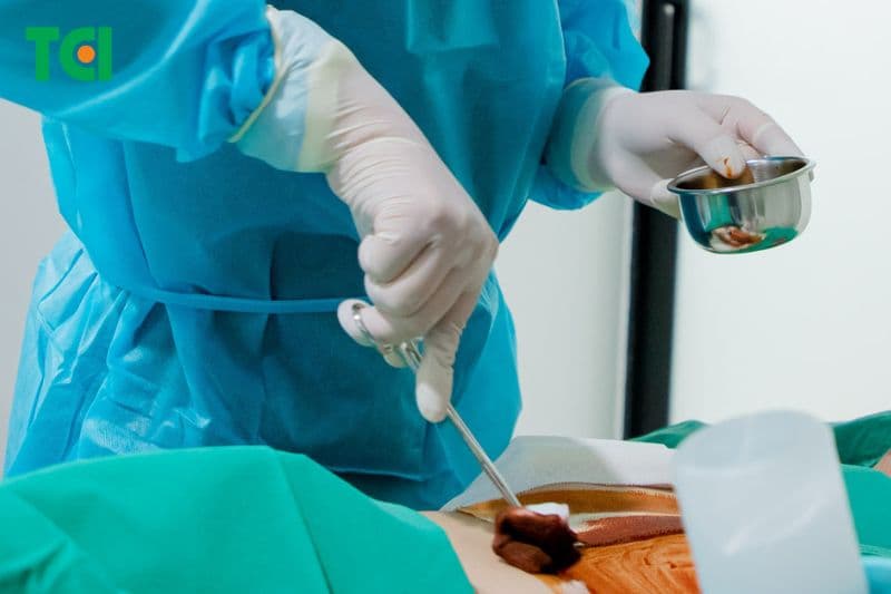 quy trình kỹ thuật chích rạch áp xe nhỏ