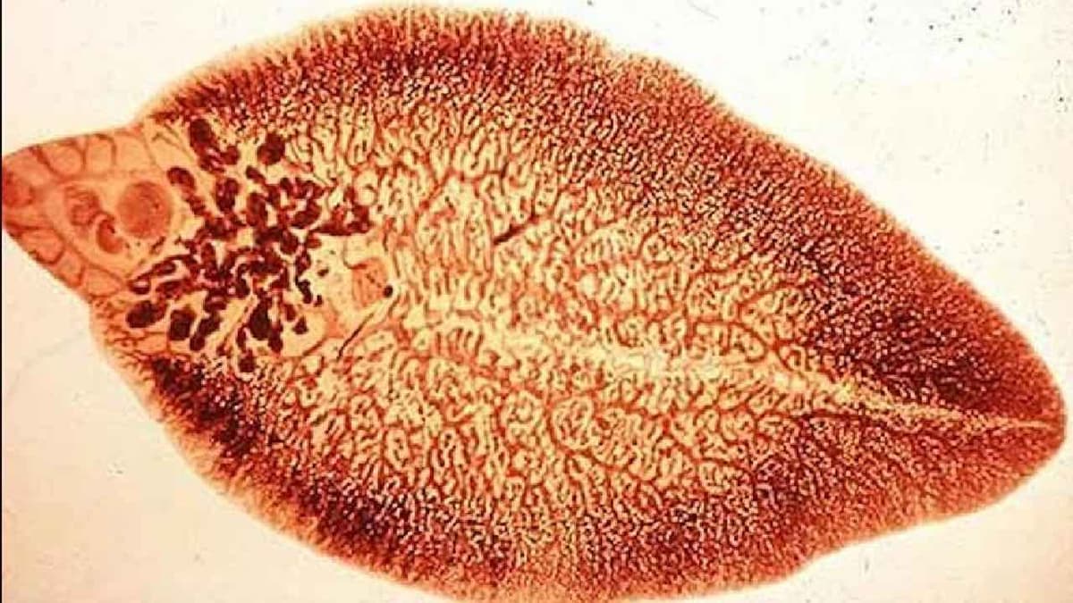Sán lá gan chết ở nhiệt độ bao nhiêu?