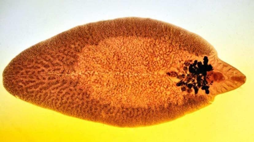 Sán lá gan lớn có chữa khỏi không? Điều trị cách nào?