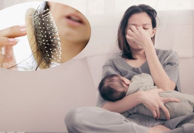 suy tuyến yên sau đẻ