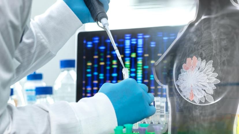 Khi nào cần xét nghiệm tầm soát gen ung thư vú? Quy trình và lưu ý