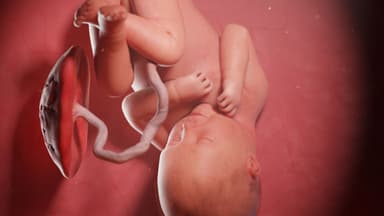 Điều gì sẽ xảy ra nếu em bé của bạn ở tư thế ngôi ngược (ngôi mông)?