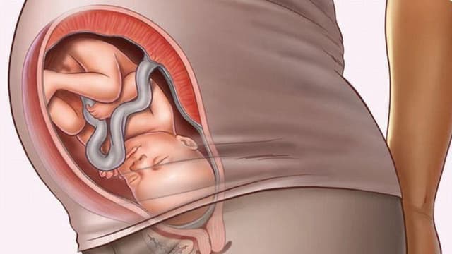 Thai nhi quay đầu mấy lần? Bắt đầu từ tháng thứ mấy?