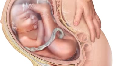 Ngôi thai ngược có sinh thường được không?