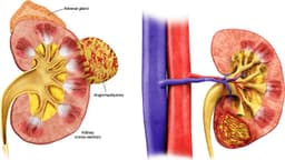 U cơ mỡ thận là bệnh gì? Có nguy hiểm không?