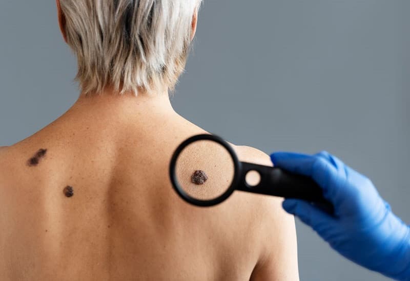 khối u lành tính có đau không