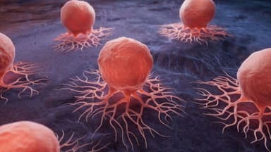 U lành tính để lâu có sao không?