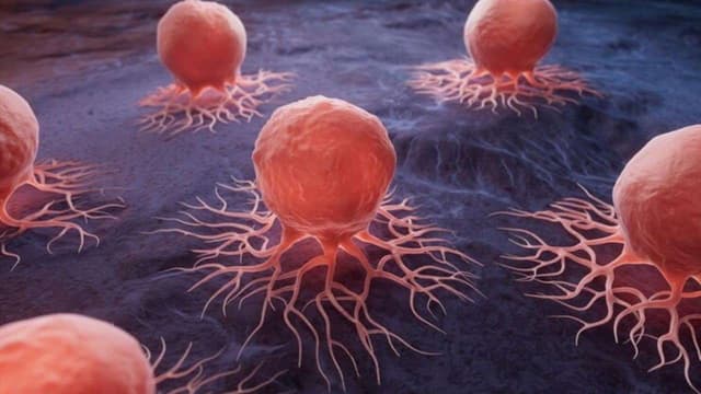 U lành tính để lâu có sao không?