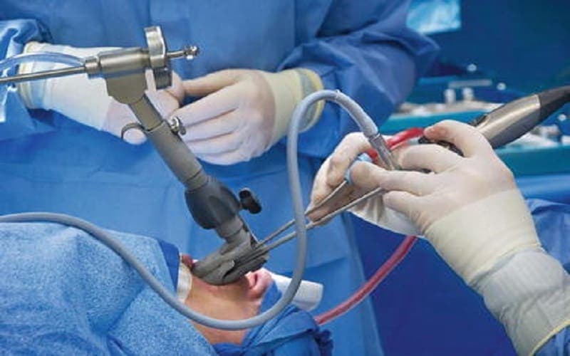 u thanh quản lành tính