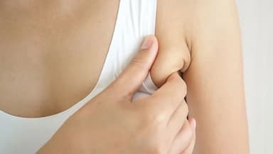 U mỡ ở nách là gì? Cách chữa?