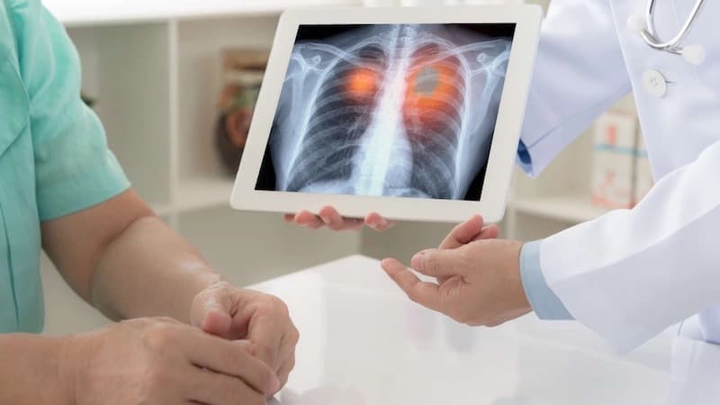 u phổi lành tính có chữa được không