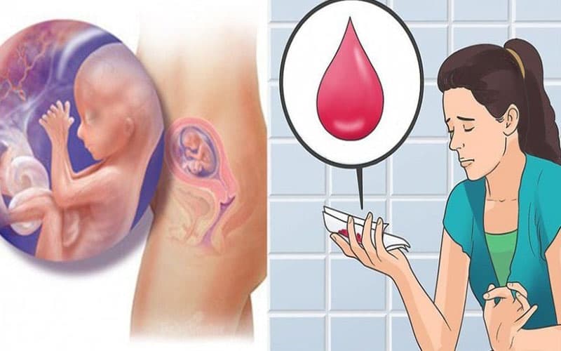 u xơ tử cung có ảnh hưởng đến thai nhi