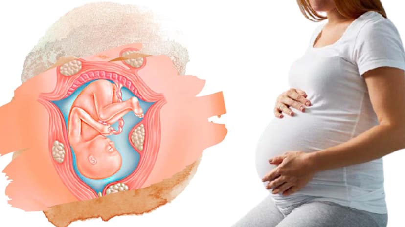 Bị u xơ tử cung có ảnh hưởng đến thai nhi?