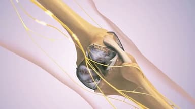 U xương lành tính có đau không?