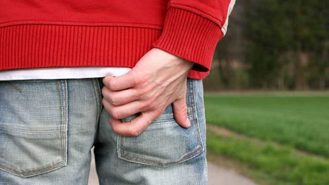 Viêm rò xoang lông vùng cùng cụt