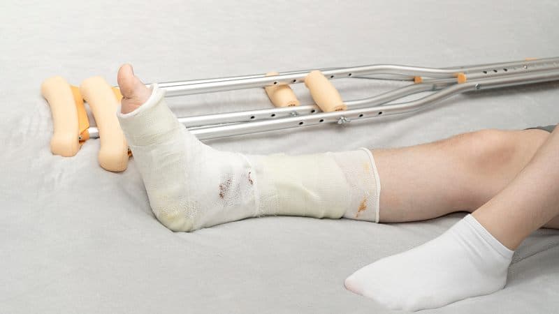 4 giai đoạn liền xương