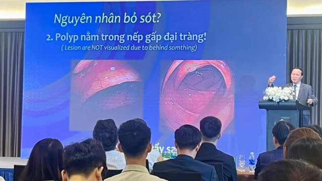 Chuyên gia lưu ý nguy cơ gây ung thư bị bỏ sót trong nội soi tiêu hóa