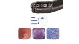Lần đầu tiên – Duy nhất tại Việt Nam: TCI ứng dụng nội soi tiêu hóa Endocyto 520x cấp độ tế bào