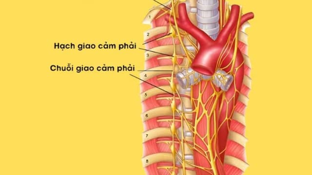 Khi nào cần đốt hạch thần kinh giao cảm: Các trường hợp được chỉ định