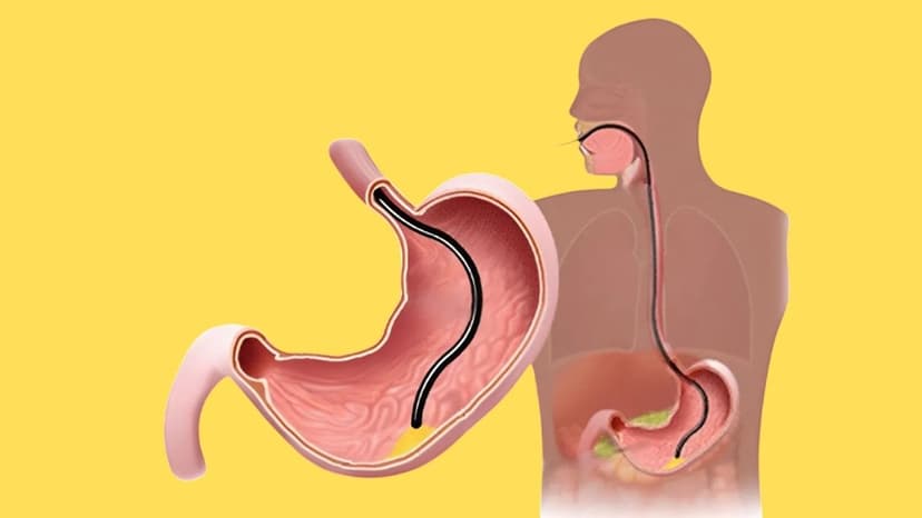 Hướng dẫn trước khi nội soi dạ dày: Chi tiết từ A đến Z