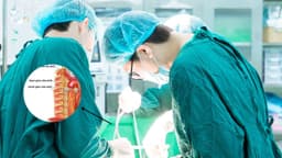 Có nên cắt hạch thần kinh giao cảm không?