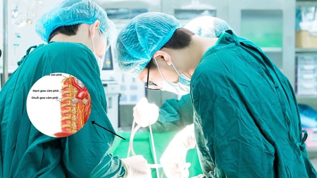 Có nên cắt hạch thần kinh giao cảm không?