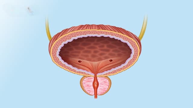 Bàng quang giảm hoạt là gì? Cách điều trị?