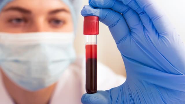 Bệnh rối loạn chuyển hóa chu trình ure