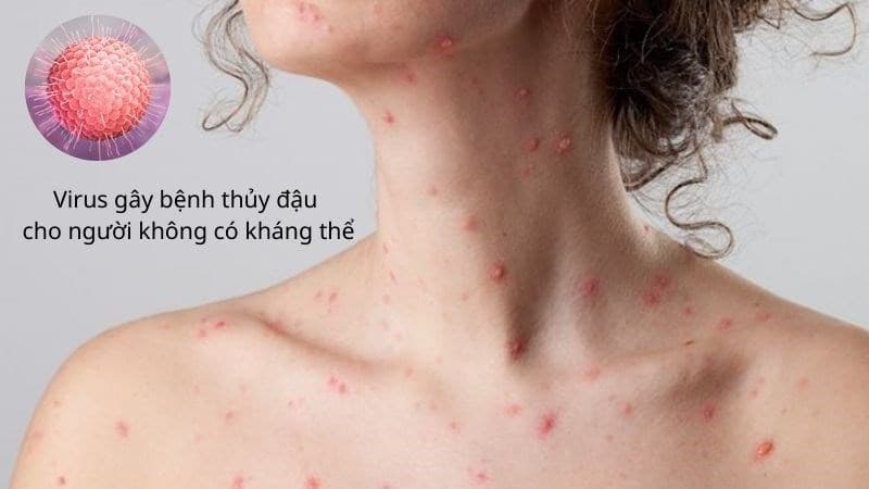 bị zona có quan hệ được không