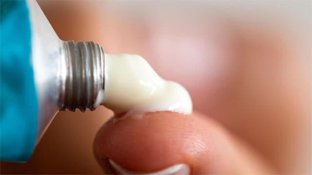 Bị zona bôi kem đánh răng được không?