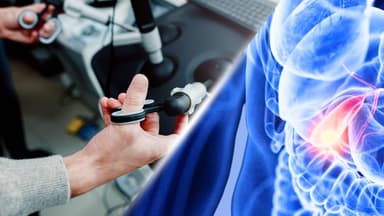 Cách điều trị bệnh ung thư đường mật