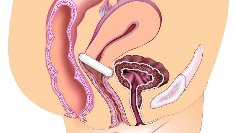 sa bàng quang có chữa được không