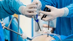 Cắt polyp đại tràng phải nằm viện bao lâu?