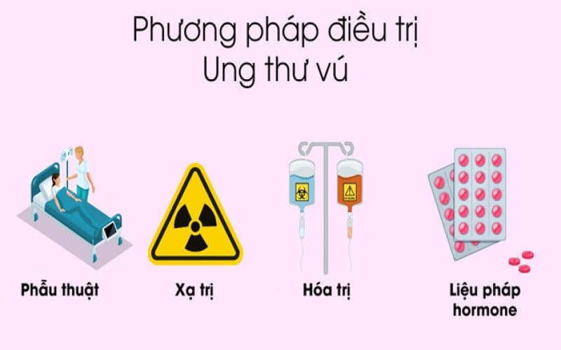 hướng dẫn chẩn đoán và điều trị ung thư vú