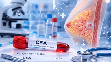 Vì sao cần quan tâm chỉ số CEA trong ung thư vú?