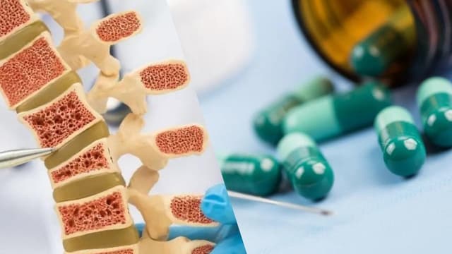 Cơ chế gây loãng xương của glucocorticoid