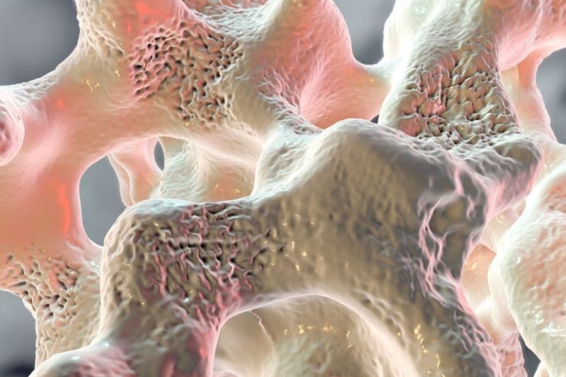 cơ chế gây loãng xương của glucocorticoid