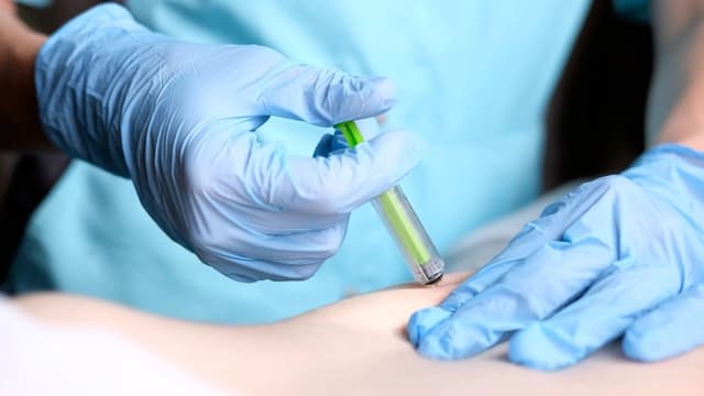 Denosumab – kháng thể người đơn dòng điều trị loãng xương