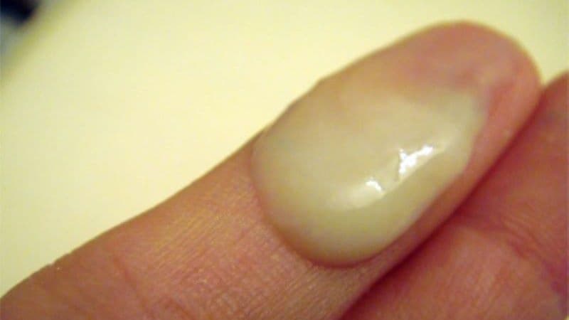 khí hư khi rụng trứng