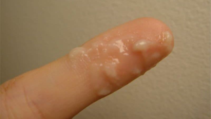 khí hư khi rụng trứng