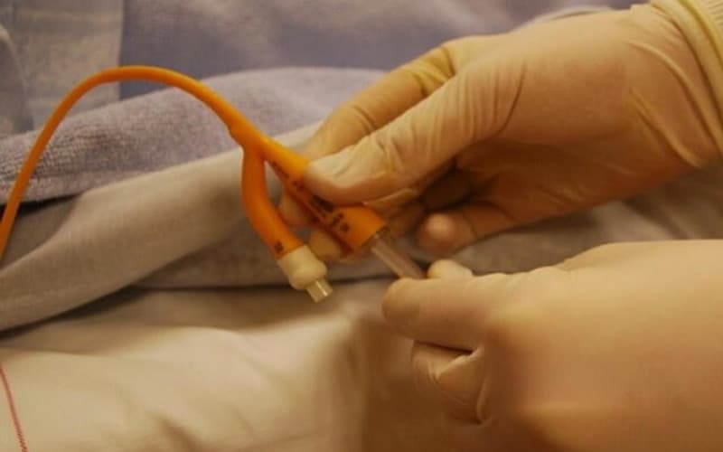 phác đồ điều trị bàng quang thần kinh