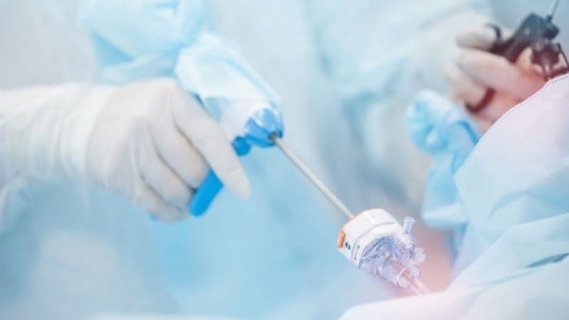 u cơ tuyến túi mật