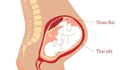 Độ dày bánh nhau theo tuổi thai