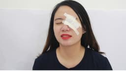 Cảnh giác đục thủy tinh thể do chấn thương mắt