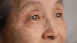 Mắt bị đục thủy tinh thể do đâu?