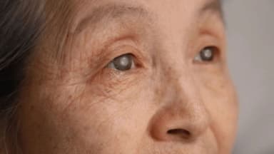 Mắt bị đục thủy tinh thể do đâu?